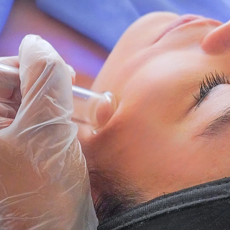 limpieza facial, hydrafacial, cliniderma